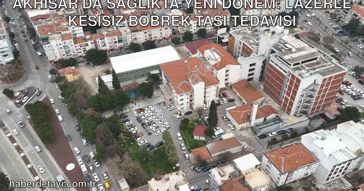 "Akhisar'da Sağlıkta Yeni Dönem: Lazerle Kesisiz Böbrek Taşı Tedavisi" başlıklı haber için fotoreali
